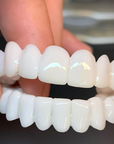 DentAlign | Professional Dental Prosthetics for Natural Smile Restoration 0