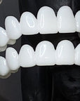 DentAlign | Professional Dental Prosthetics for Natural Smile Restoration 4