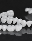 DentAlign | Professional Dental Prosthetics for Natural Smile Restoration 6