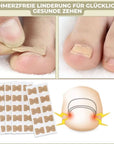 FixaNail | Nail Correction Tool for Ingrown Nails and Gentle Pain Relief 2