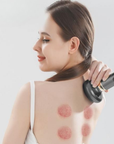 Revitaluxe | Powerful Adjustable Cupping Therapy Massager for Recovery 1