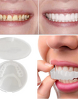 SmilePro | Instant Comfortable Flexible Denture Solution 1