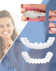 SmileSnap | Perfect Veneer Snap-On Teeth for a Confident Smile 2