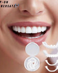 SnapFit | Innovative Customizable Dental Veneers for Perfect Smile 1