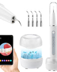 SparkleScan - Ultrasonic Dental Cleaner & Calculus Eliminator 2
