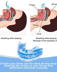 AureaGuard | Comfortable Adjustable Anti-Snoring Mouthpiece Guard 2