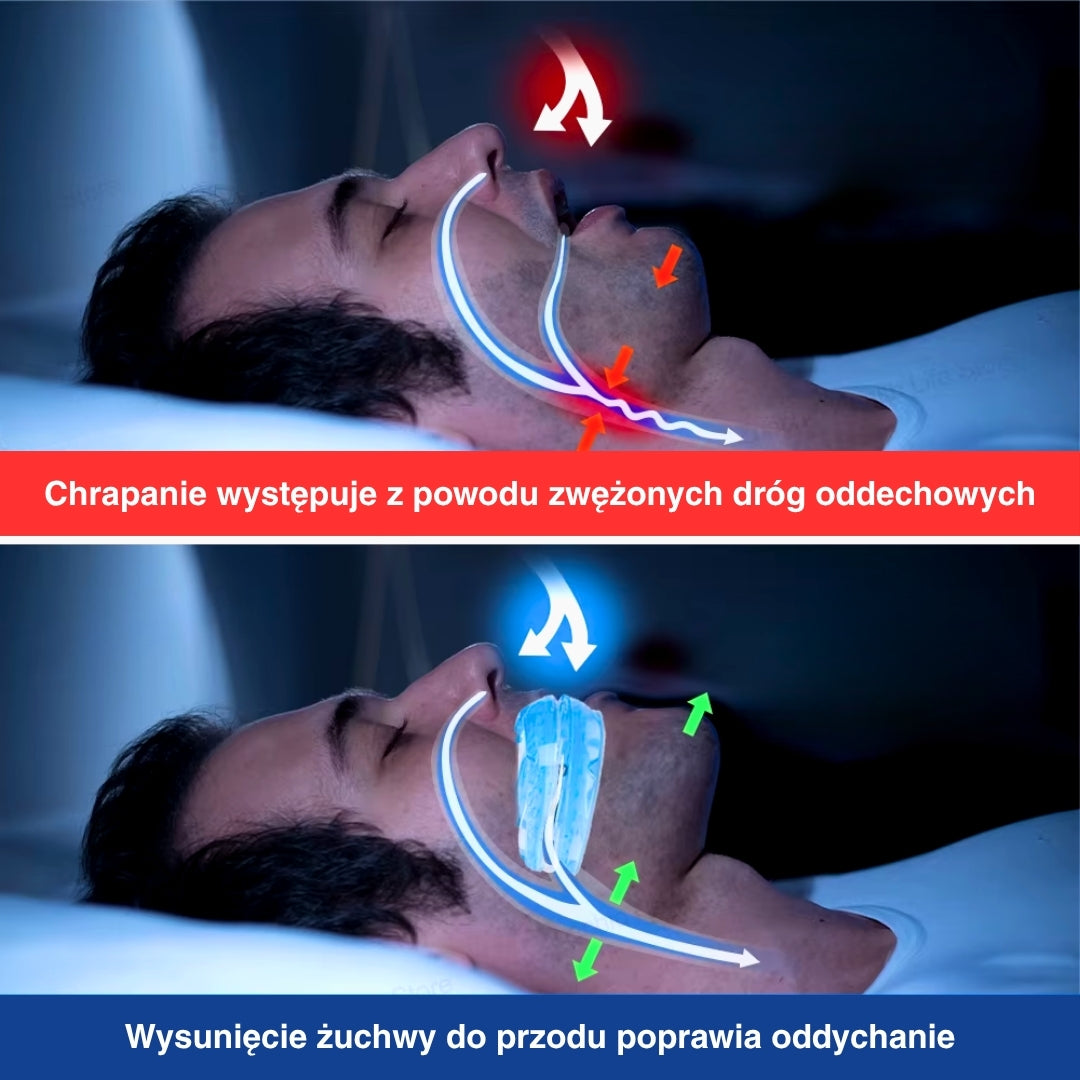 AureaGuard | Comfortable Adjustable Anti-Snoring Mouthpiece Guard 3