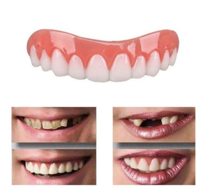 AureliaSmile | Innovative Comfortable Dental Cover for Flawless Teeth 0