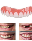 AureliaSmile | Innovative Comfortable Dental Cover for Flawless Teeth 0