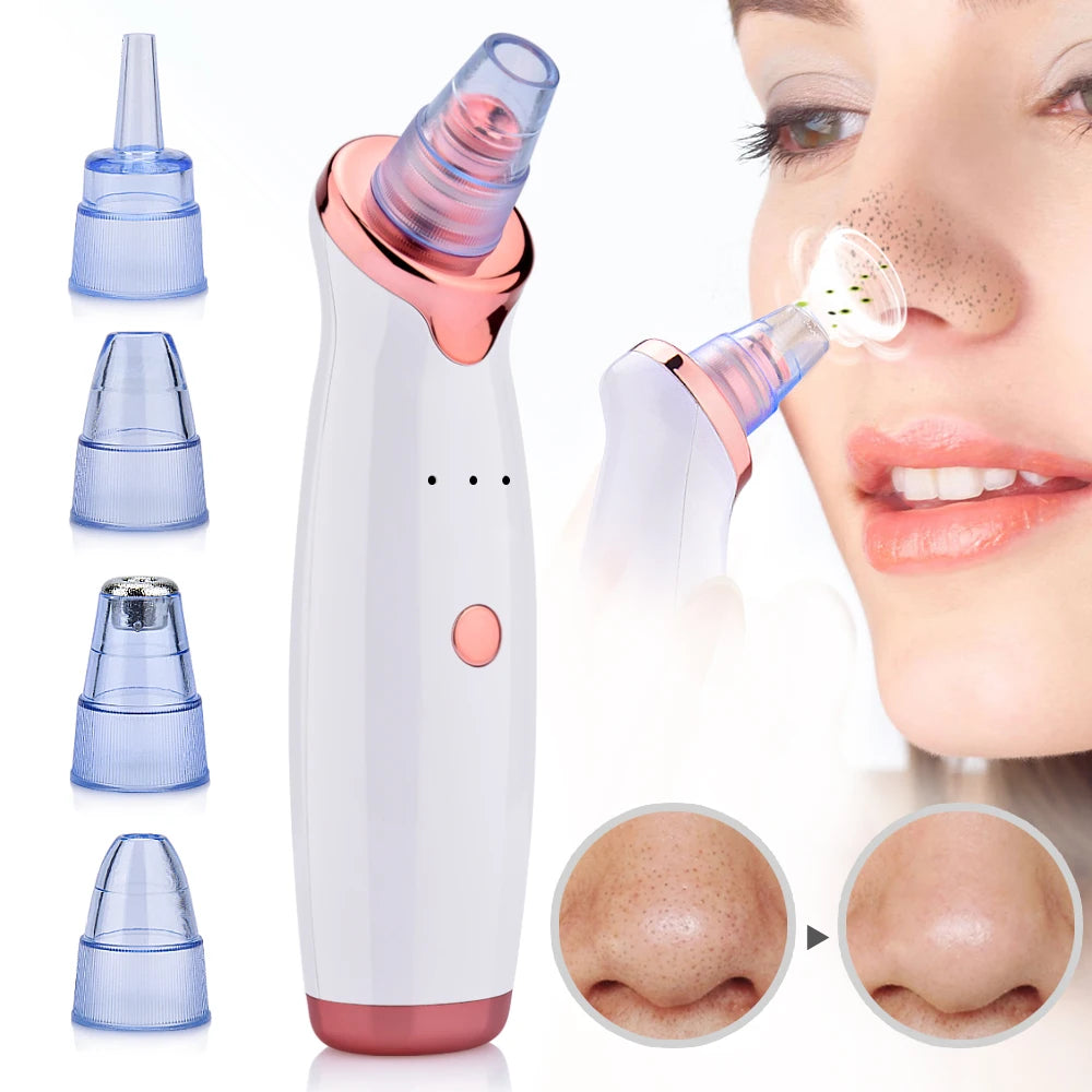 Blackhead & Acne Vacuum Tool for Clear Skin ABS 0
