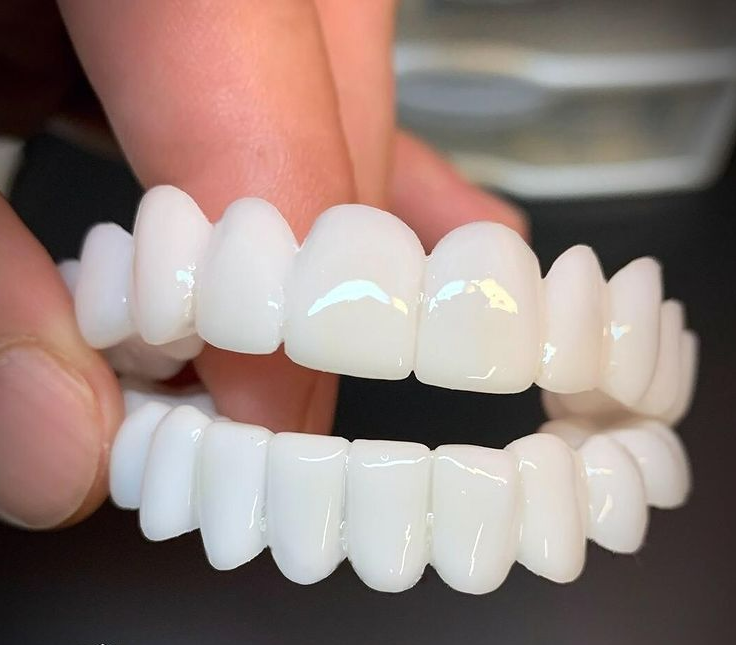 DentAlign | Professional Dental Prosthetics for Natural Smile Restoration 0