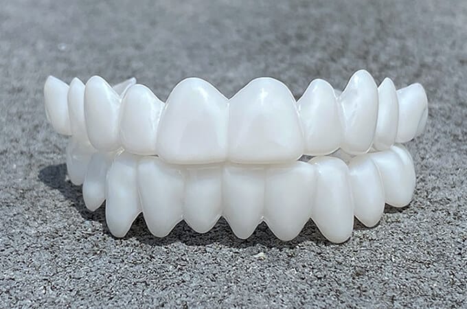 DentAlign | Professional Dental Prosthetics for Natural Smile Restoration 1