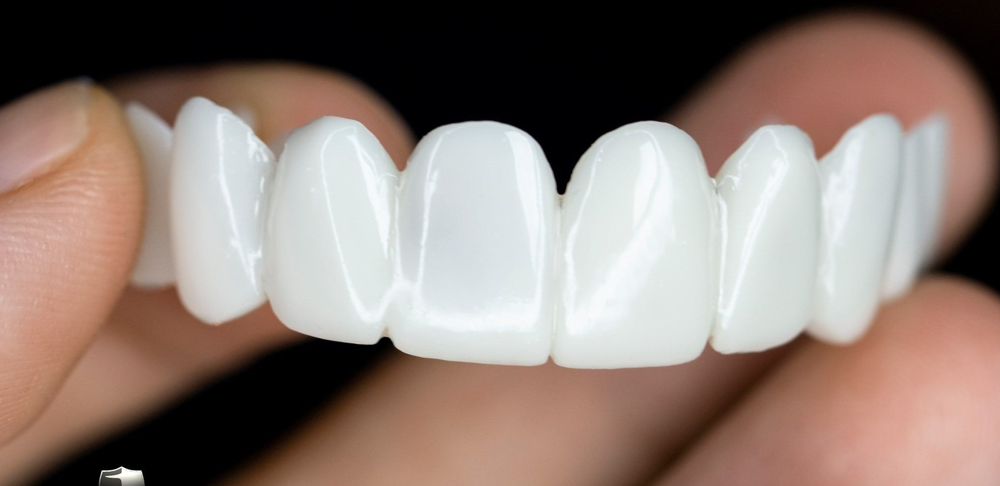 DentAlign | Professional Dental Prosthetics for Natural Smile Restoration 3
