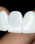 DentAlign | Professional Dental Prosthetics for Natural Smile Restoration 3