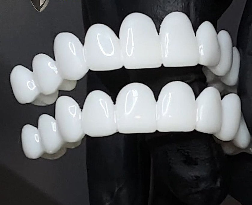 DentAlign | Professional Dental Prosthetics for Natural Smile Restoration 4