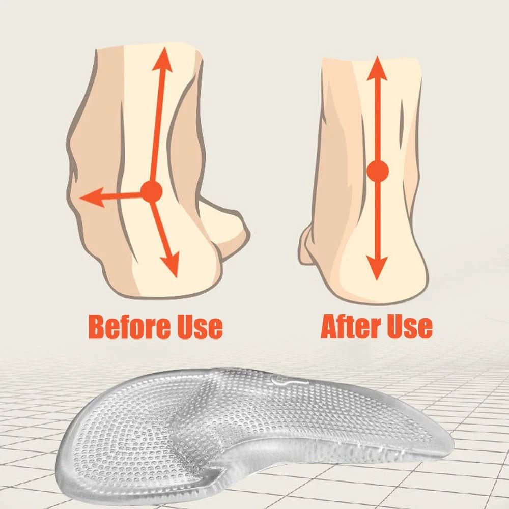 FasciaFix | Orthopedic Gel Insoles for Plantar Fasciitis Support and Pain Relief 5
