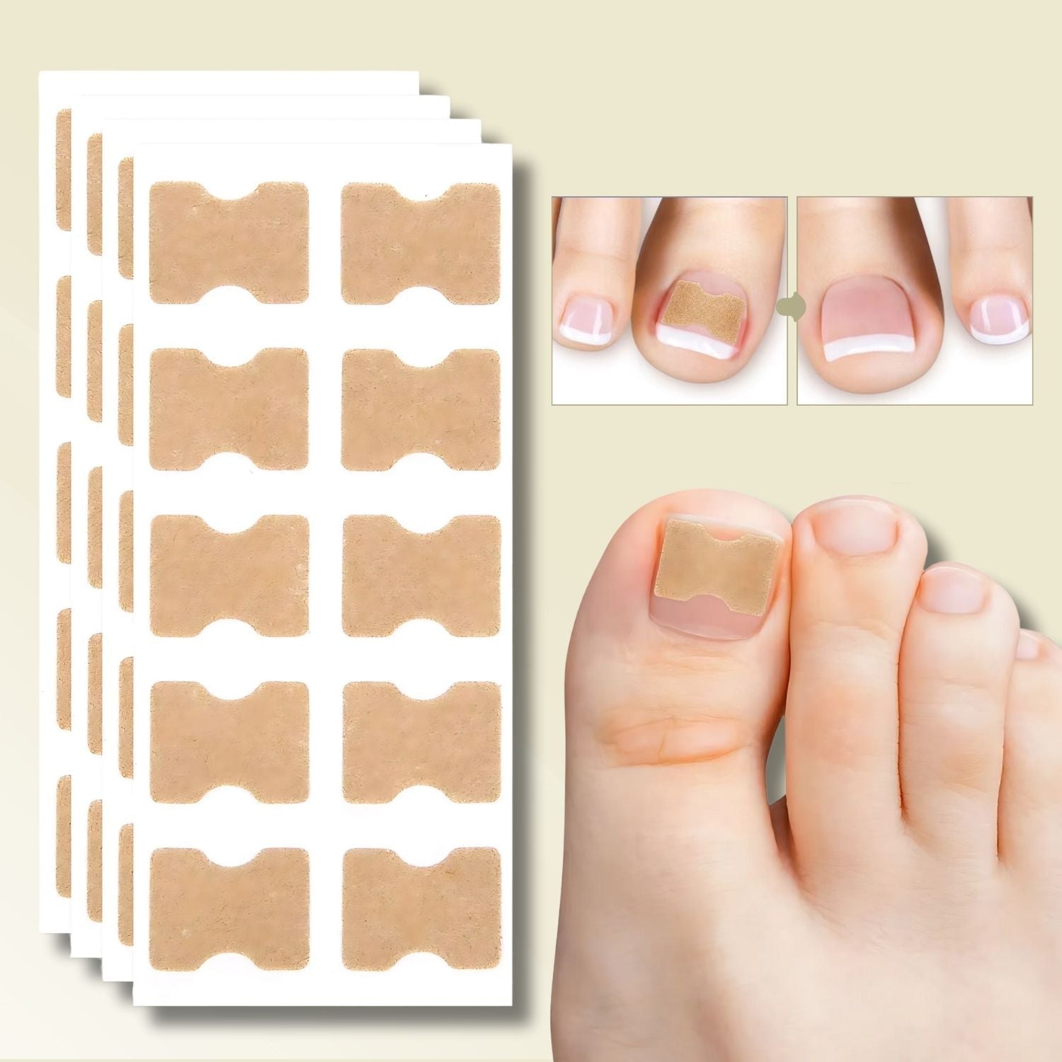 Instant Nail Repair Patches for Ingrown Nails – 10 Pack for Healthy Growth and Pain Relief 0