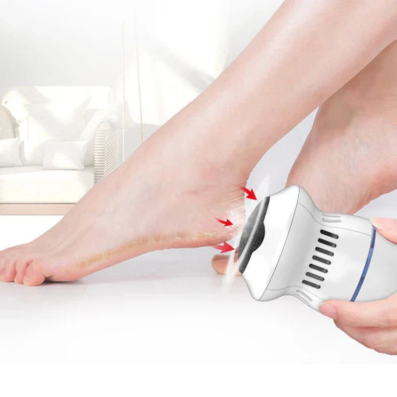 PediGlow | Effective Ergonomic Electric Callus Remover for Smooth Feet 2