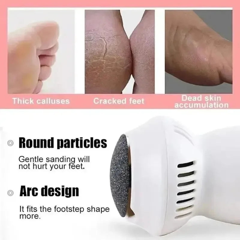 PediGlow | Effective Ergonomic Electric Callus Remover for Smooth Feet 4