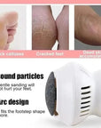 PediGlow | Effective Ergonomic Electric Callus Remover for Smooth Feet 4