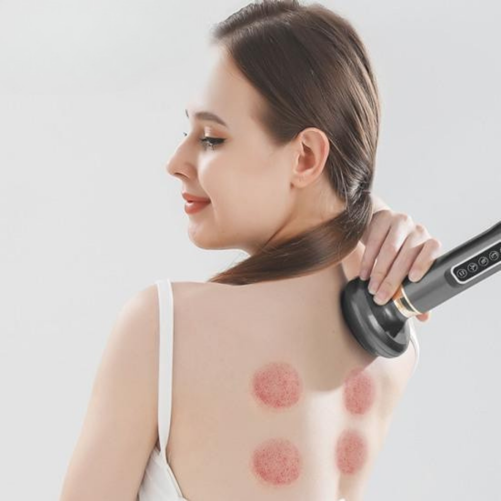 Revitaluxe | Powerful Adjustable Cupping Therapy Massager for Recovery 1
