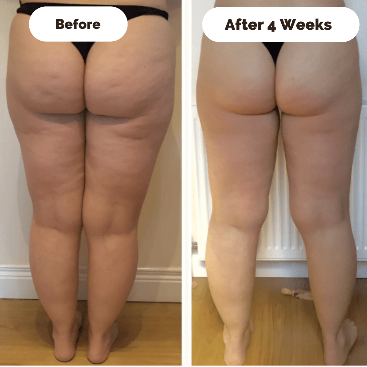 SkinLift | Firming Massage Device for Reducing Cellulite and Tightening Skin 3