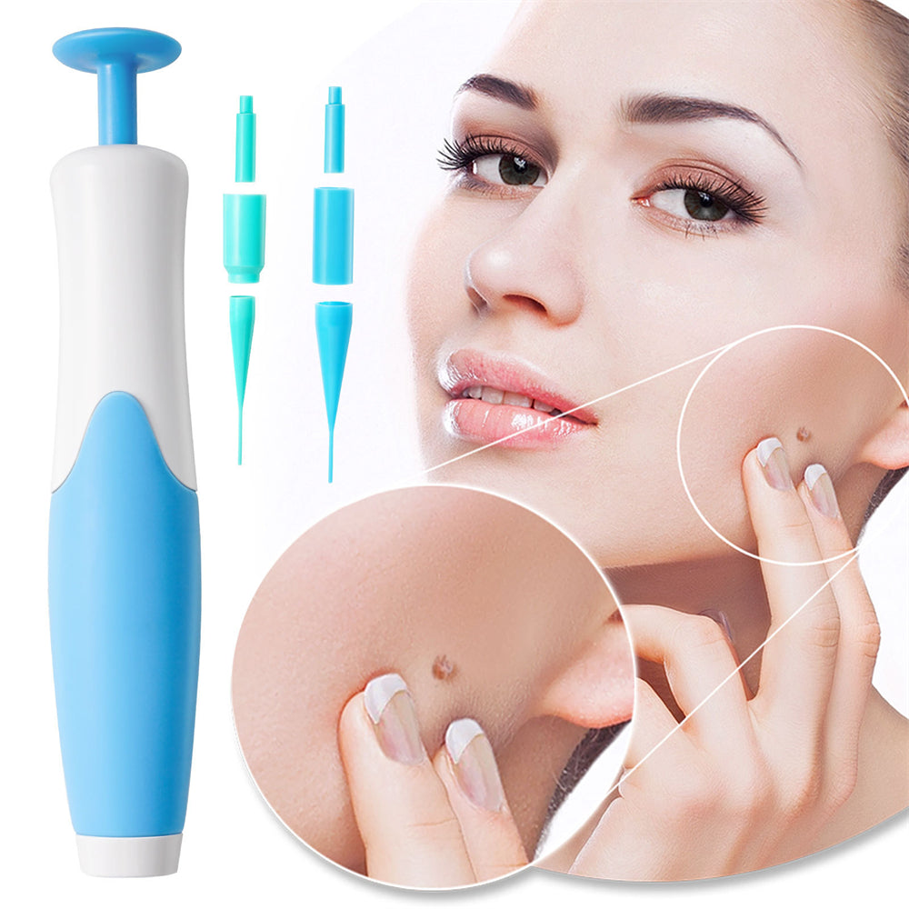 Skin Tag Remover Kit for Painless Removal of Skin Tags, Warts, and Moles – Fast Results at Home 0