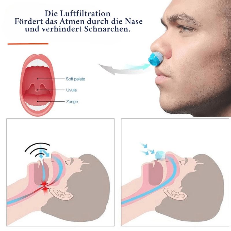 SleepPure | Anti-Snoring Air Filter Device for Restful, Healthy Sleep 4
