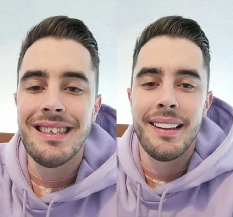 SmileGuard | Professional Dental Night Guard for Teeth Protection 2