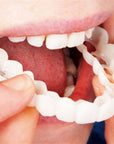 SmileSnap | Perfect Veneer Snap-On Teeth for a Confident Smile 1