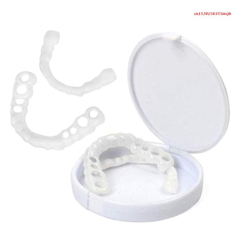 SmileSnap | Perfect Veneer Snap-On Teeth for a Confident Smile 4
