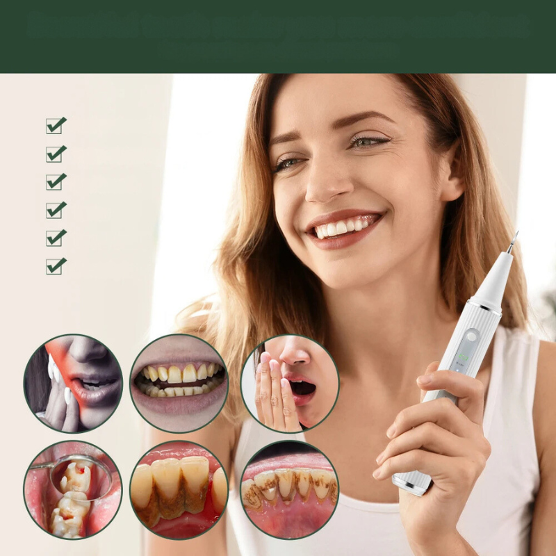 SparkleScan - Ultrasonic Dental Cleaner & Calculus Eliminator 1