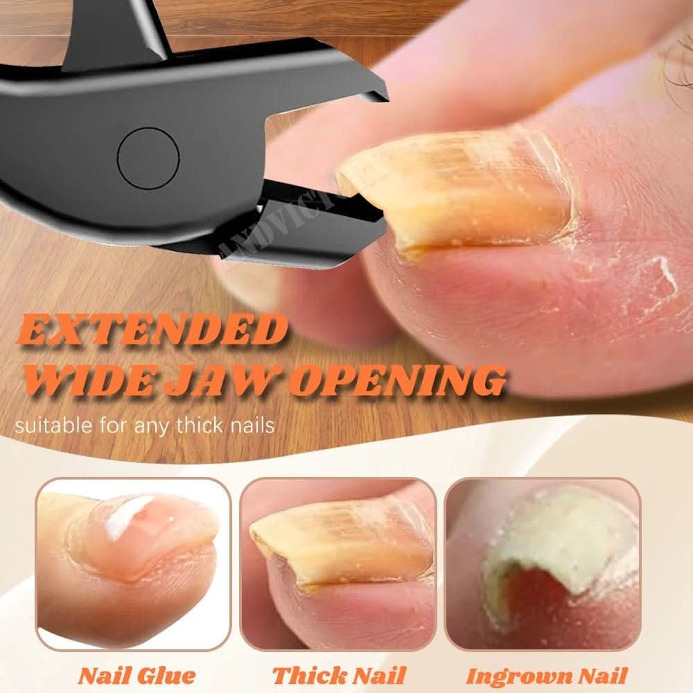 TrimTech | Precision Toe Nail Clippers for Accurate and Effortless Grooming 2